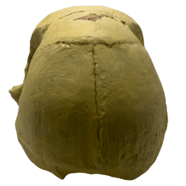 Homo erectus georgicus - Image 4