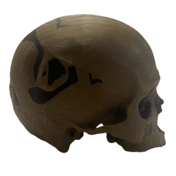 Homo sapiens (Chancelade Man) - Image 7