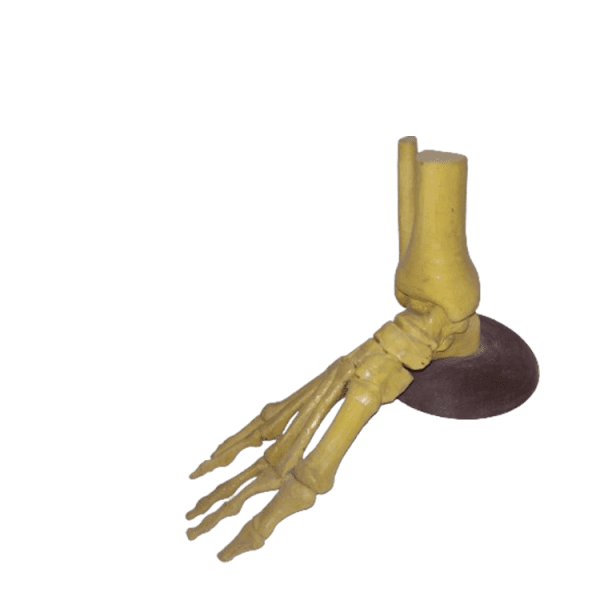 Disarticulated Foot