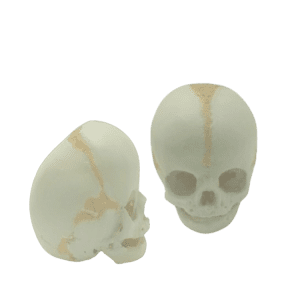 Foetal Skull