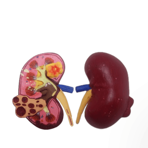 Kidney Renal Failure