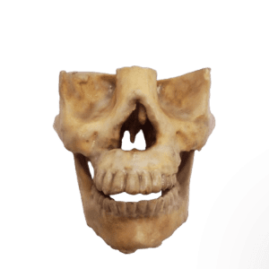 Mandible and Maxilla Drillable